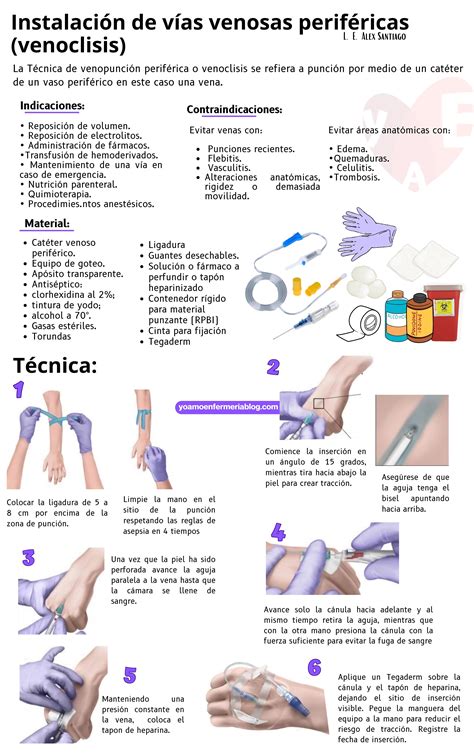 Infografía sobre la técnica de inserción cruzada de pasadores en cabello fino