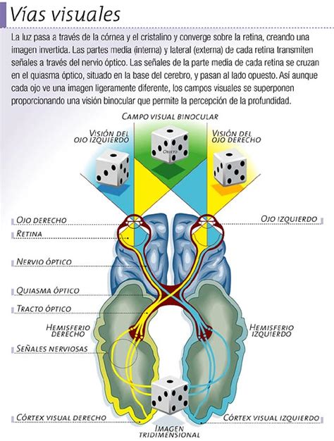 Diagrama de las vías visuales en el cerebro y puntos de posible lesión