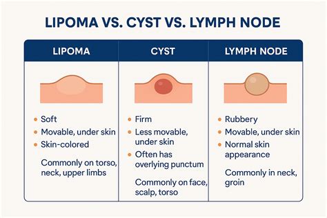 Infografía: Comparación visual entre quiste cutáneo y lipoma