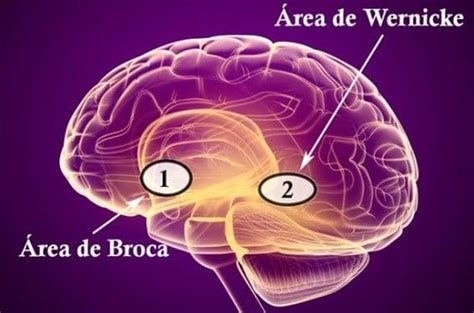 Diagrama del cerebro humano resaltando las áreas de Broca y Wernicke.