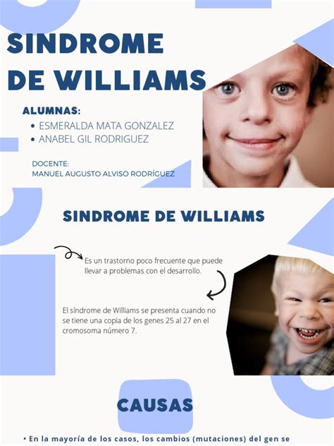 ilustración de las características faciales del síndrome de Williams