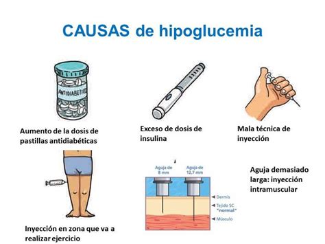 Esquema de las causas de la hipoglucemia en personas no diabéticas, incluyendo medicamentos, alcohol, enfermedades graves, inanición y producción excesiva de insulina.