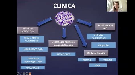 Infografía: Métodos de diagnóstico de gammapatías monoclonales (electroforesis, inmunofijación, FLC)