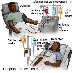 Infografía: Pasos del trasplante de células madre