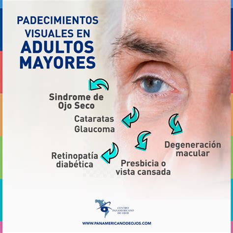 Infografía: Cambios visuales comunes en adultos mayores