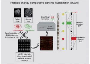 Microarray de hibridación genómica comparada
