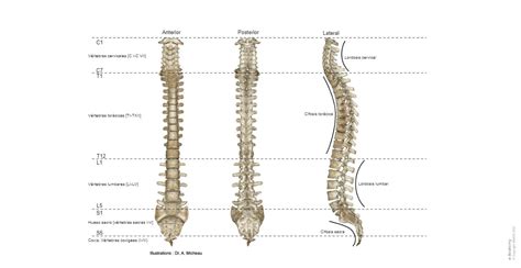 Esquema de columna vertebral con cifosis