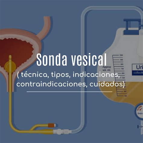 Diagrama ilustrando el proceso de vaciado vesical