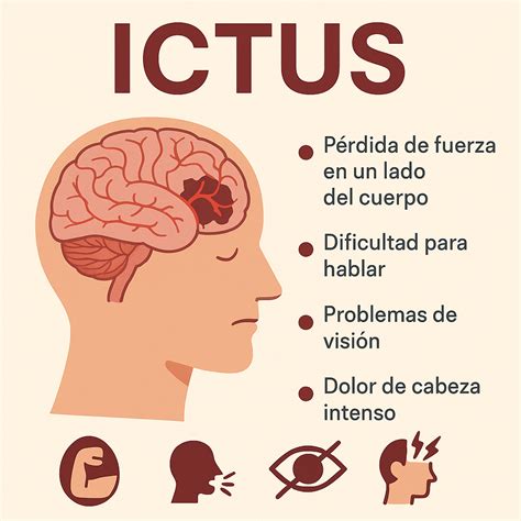 Infografía paso a paso sobre la técnica F.A.S.T. para identificar un ictus en adultos mayores.