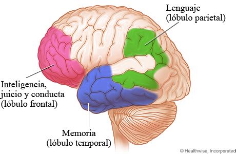 Esquema de las áreas del cerebro afectadas por la demencia