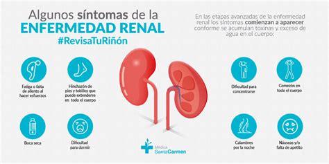 Esquema de los síntomas de la insuficiencia renal
