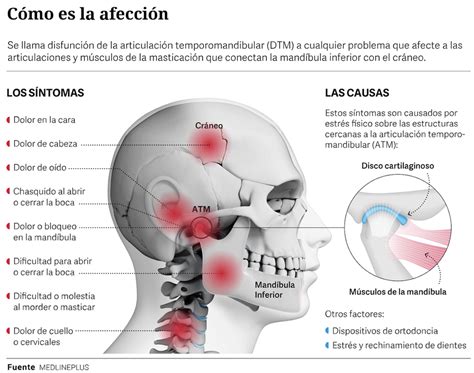 Infografía: Causas comunes de disfunción temporomandibular y retrognatia.