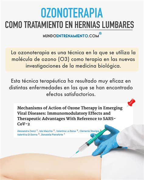 Imagen ilustrativa de aplicación de ozonoterapia intraarticular