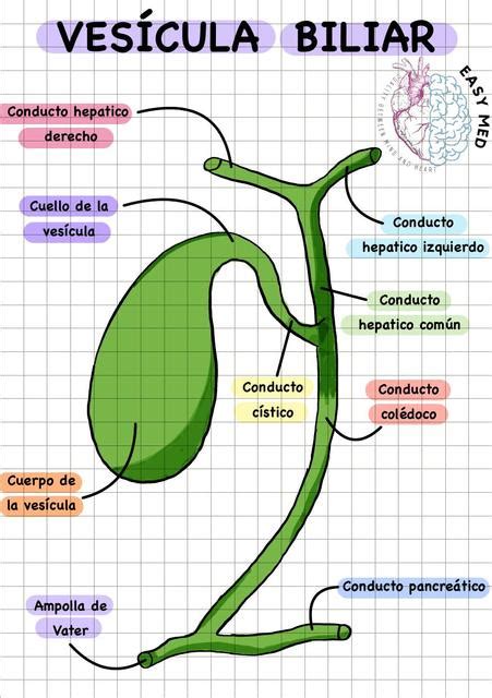 Esquema de la vesícula biliar con depósitos de colesterol en la pared