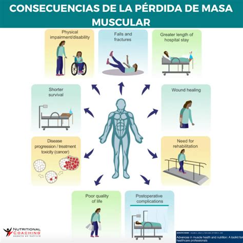 Ilustración que muestra la pérdida de masa muscular y fuerza en personas mayores.