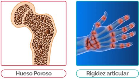 Esquema de los efectos del envejecimiento en huesos y articulaciones