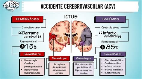Esquema de los tipos de accidente cerebrovascular (isquémico y hemorrágico)