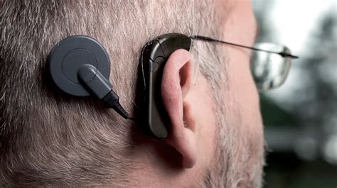 fotografía de personas utilizando implantes cocleares o audífonos