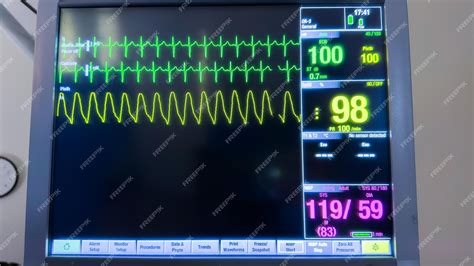 monitor de signos vitales en un consultorio dental durante un procedimiento, con equipo de oxígeno