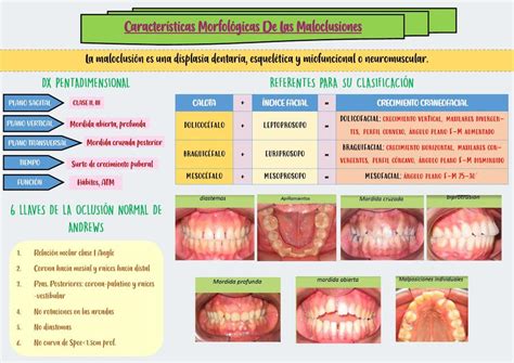 Infografía comparando diferentes tipos de maloclusiones dentales