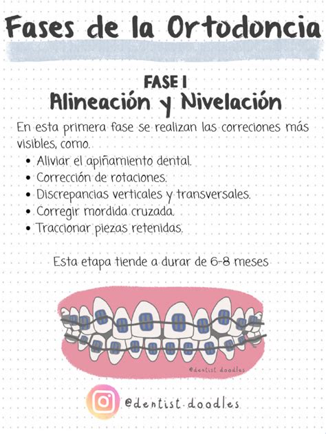 Esquema de las fases del tratamiento de ortodoncia