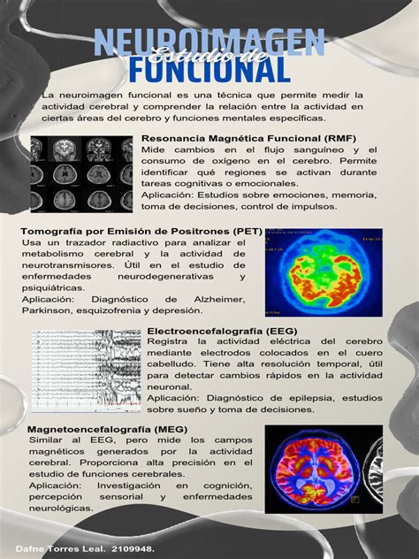 comparación visual de neuroimagen estructural y funcional