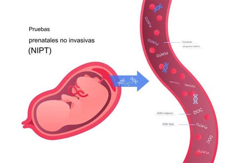 Diagrama que ilustra el proceso de pruebas prenatales para la detección de anomalías genéticas.