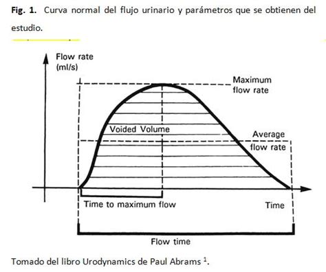 Gráfico de curva de uroflujometría normal (Fig. 1)