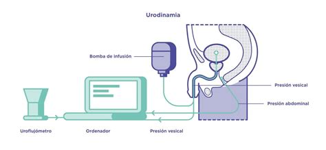 Diagrama de colocación de catéteres para estudio urodinámico (Fig. 3)