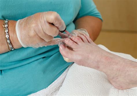 Ilustración: Cómo cuidar las uñas de los pies en personas mayores