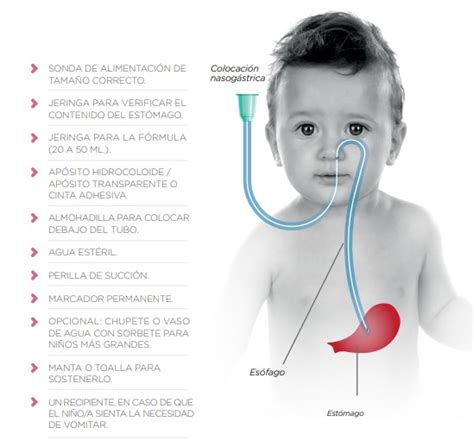 Infografía: Componentes de un sistema de alimentación por sonda con bomba portátil.
