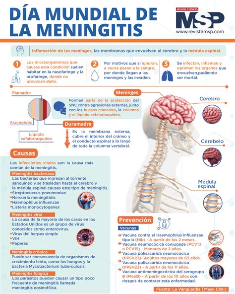 infografía de los tipos de meningitis y sus causas principales