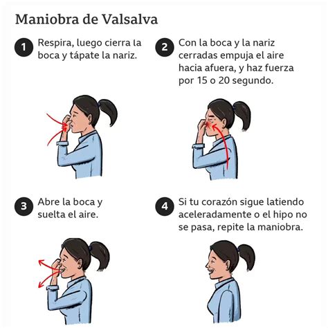 Comparación de la maniobra de Valsalva en condiciones normales (A) y anormales con cistocele o prolapso (B)