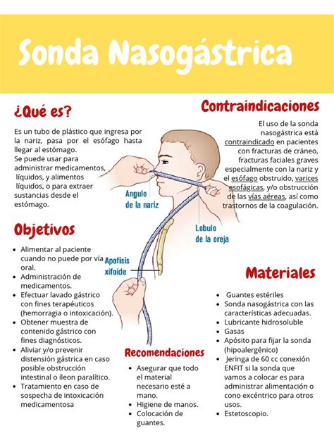Diagrama comparativo de una sonda nasogástrica y una sonda de gastrostomía (PEG), mostrando su vía de inserción y destino final.