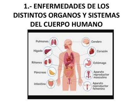 Ilustración mostrando diferentes sistemas del cuerpo humano y las enfermedades más comunes asociadas a la vejez.