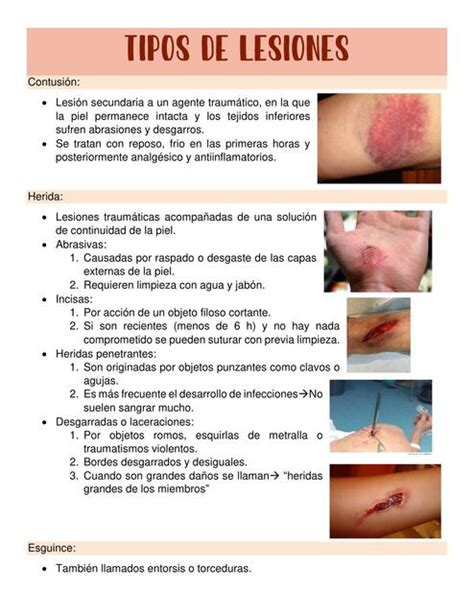 Infografía: Causas y tipos de lesiones al nacer