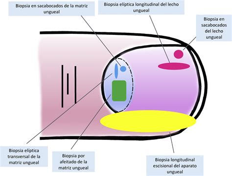 Esquema ilustrativo del procedimiento de presión ungueal y retorno del color para la evaluación de la perfusión periférica.