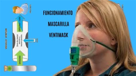 diagrama explicando el efecto Venturi en una mascarilla de oxígeno
