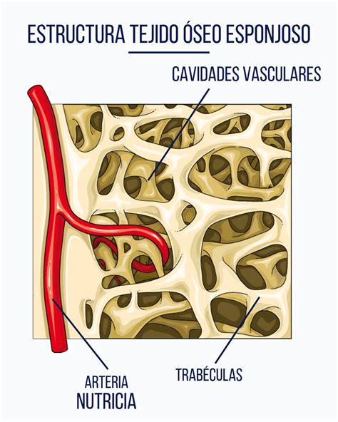 Esquema ilustrativo que compara un hueso sano con tejido denso frente a un hueso con osteoporosis y porosidad aumentada.