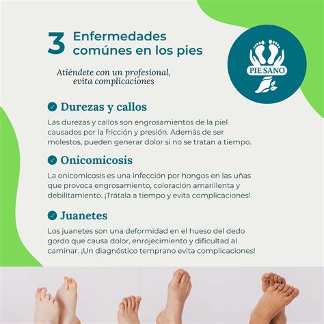 Esquema: Diferencias entre un pie sano y un pie con patologías comunes como juanetes o uñas encarnadas.