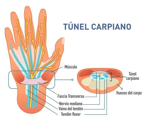 Diagrama del túnel carpiano y el nervio mediano
