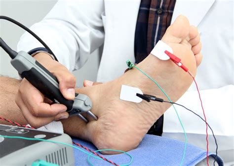 Imagen de una electromiografía (EMG)