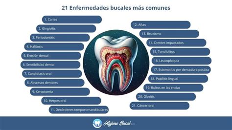 Infografía: Prevalencia global de las enfermedades bucodentales en diferentes grupos de edad