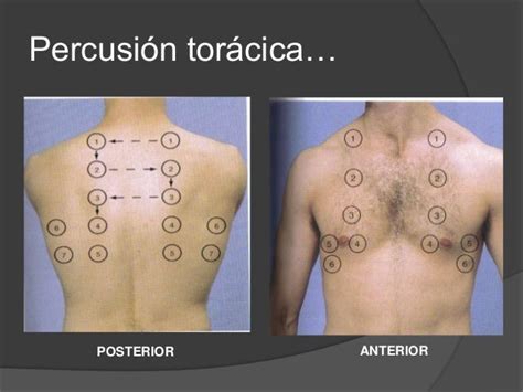 Diagrama que muestra la técnica de percusión dígito-digital del tórax
