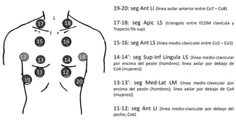 Esquema de los sitios de auscultación pulmonar en las caras anterior y posterior del tórax
