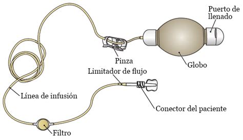 Esquema de las partes y conexión de una bomba elastomérica con un catéter