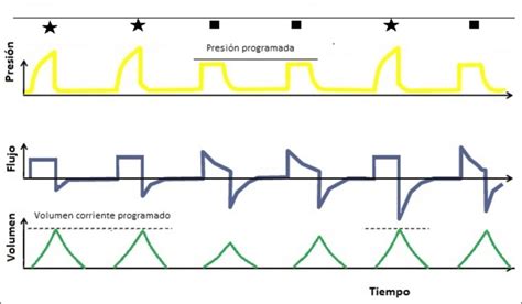 Diagrama de curvas de flujo y presión para la ventilación SIMV, mostrando respiraciones mandatorias y espontáneas