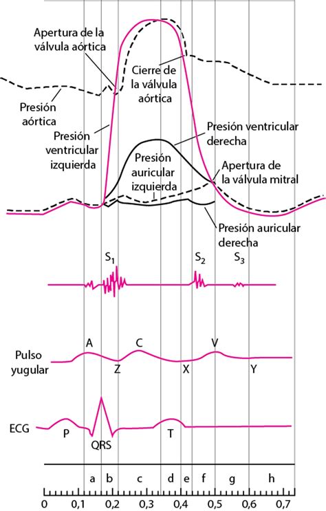 Diagrama de curvas de presión y flujo para la ventilación con Presión de Soporte, ilustrando el apoyo inspiratorio del respirador