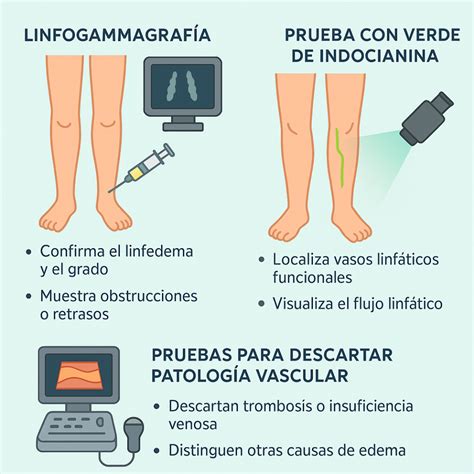 Infografía que muestra cómo se produce el linfedema debido a un bloqueo en el sistema linfático.