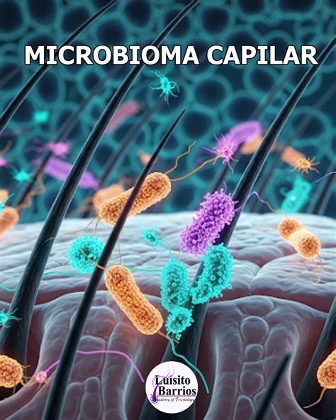 Esquema del microbioma del cuero cabelludo y la proliferación de Malassezia